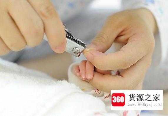 婴儿脸上湿疹怎么办最佳治疗方法是什么