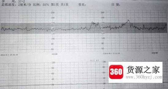 产检项目及时间表